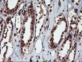 Monoclonal Mouse anti-Human SAMHD1 Antibody (clone OTI2A5, IHC, IF, WB)