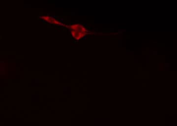 COL4A2 / Collagen IV Alpha2 Antibody