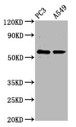 IHC-plus™ CYP1B1 Antibody