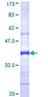 Human cDNA: FLJ23201 fis, clone KAIA38872. Protein (Recombinant GST)