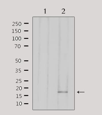 IHC-plus™ Polyclonal Rabbit anti-Human AIF1 / IBA1 Antibody (IHC, IF, WB)