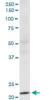 Monoclonal Mouse anti-Human NDUFV2 Antibody (clone 1A10, WB)