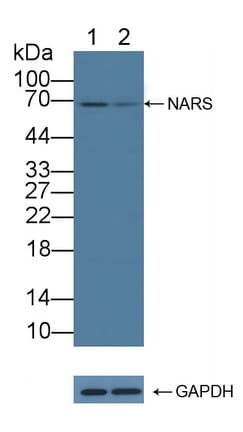 Polyclonal Rabbit anti-Human NARS Antibody (WB)