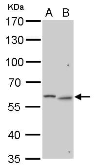 GALNS / Chondroitinase Antibody (aa20-259)
