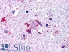 PathPlus™ LGR6 Antibody (N-terminal extracellular domain)