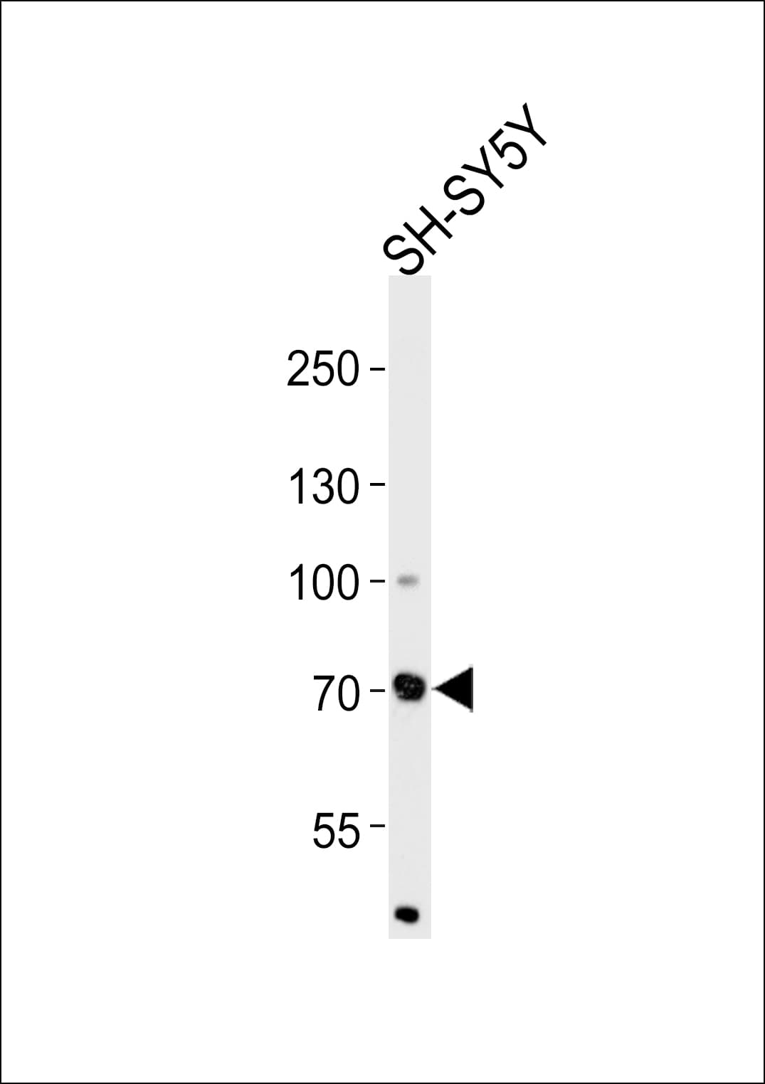 Polyclonal Rabbit anti-Human ZFP219 / ZNF219 Antibody (aa154-183, IHC, WB)