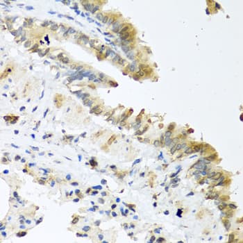 Polyclonal Rabbit anti-Human WNT5A Antibody (IHC, WB)