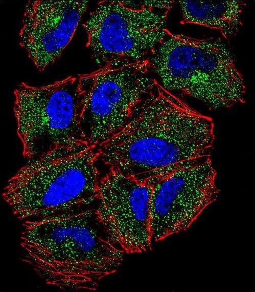 Polyclonal Rabbit anti-Human PLCL2 Antibody (aa1099-1126, IHC, IF, WB)