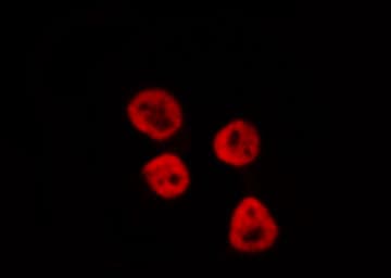 PPARA / PPAR Alpha Antibody