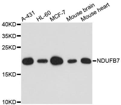 NDUFB7 / B18 Antibody