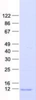 Human MGP / Matrix Gla-Protein (Recombinant His, N-Terminal)