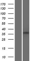 FAM86B2 Protein (Over-Expression Lysate Myc-DDK (Flag))