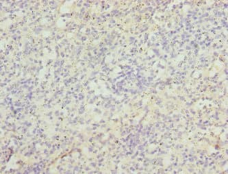 ZBTB48 / HKR3 Antibody