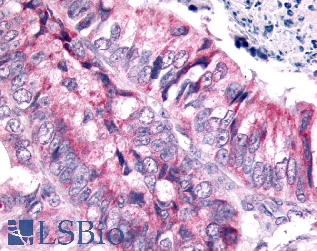 PathPlus™ SGK2 Antibody (Internal)