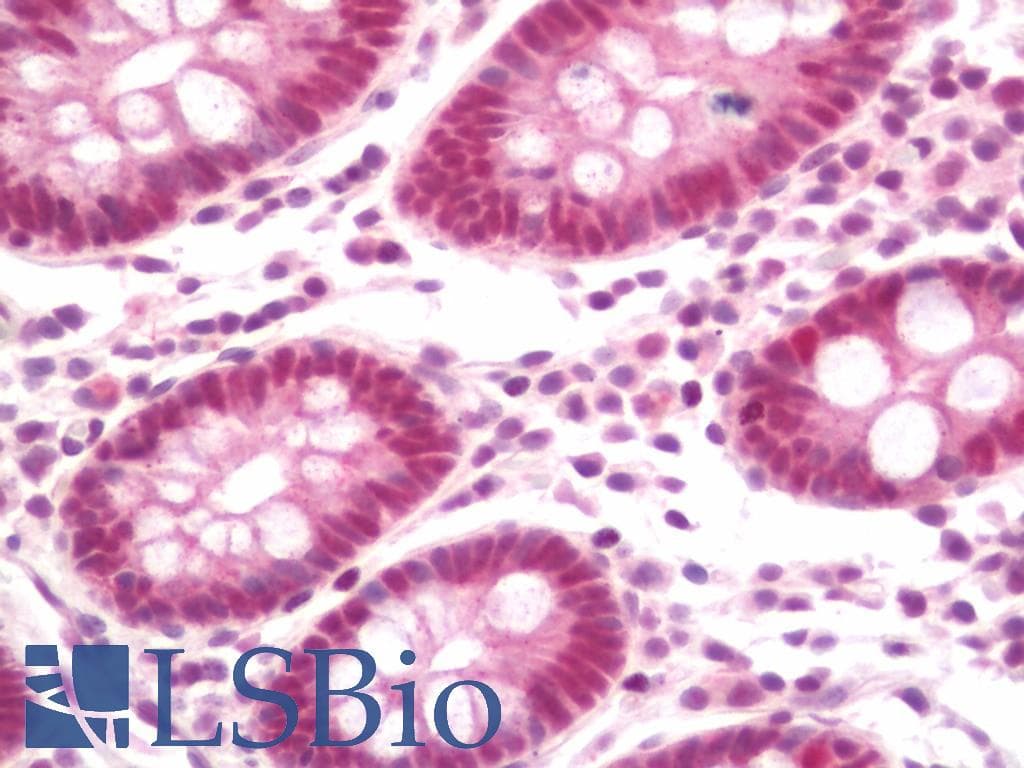 IHC-plus™ GATAD2A Antibody (aa573-633)