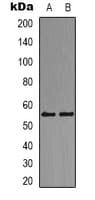 Polyclonal Rabbit anti-Human DOK2 Antibody (Internal, IHC, IF, WB)