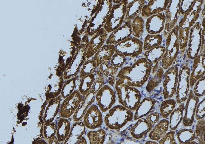 NDUFS5 Antibody