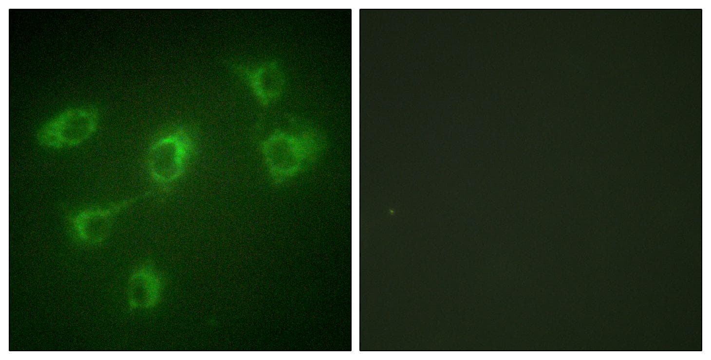Betaglycan / TGFBR3 Antibody
