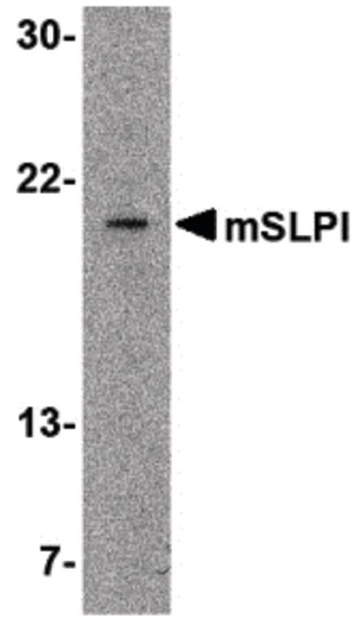 SLPI / Antileukoproteinase Antibody