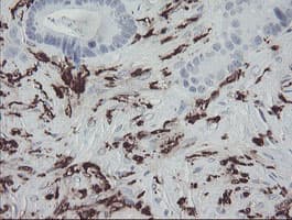 F13A1 / Factor XIIIa Antibody (clone OTI3F1)