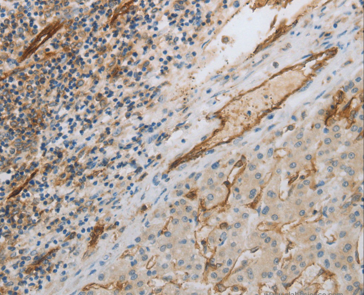 Polyclonal Rabbit anti-Human PECAM-1 / CD31 Antibody (IHC, WB)