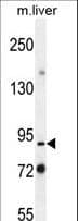 Polyclonal Rabbit anti-Mouse PARP9 Antibody (aa441-470, WB)