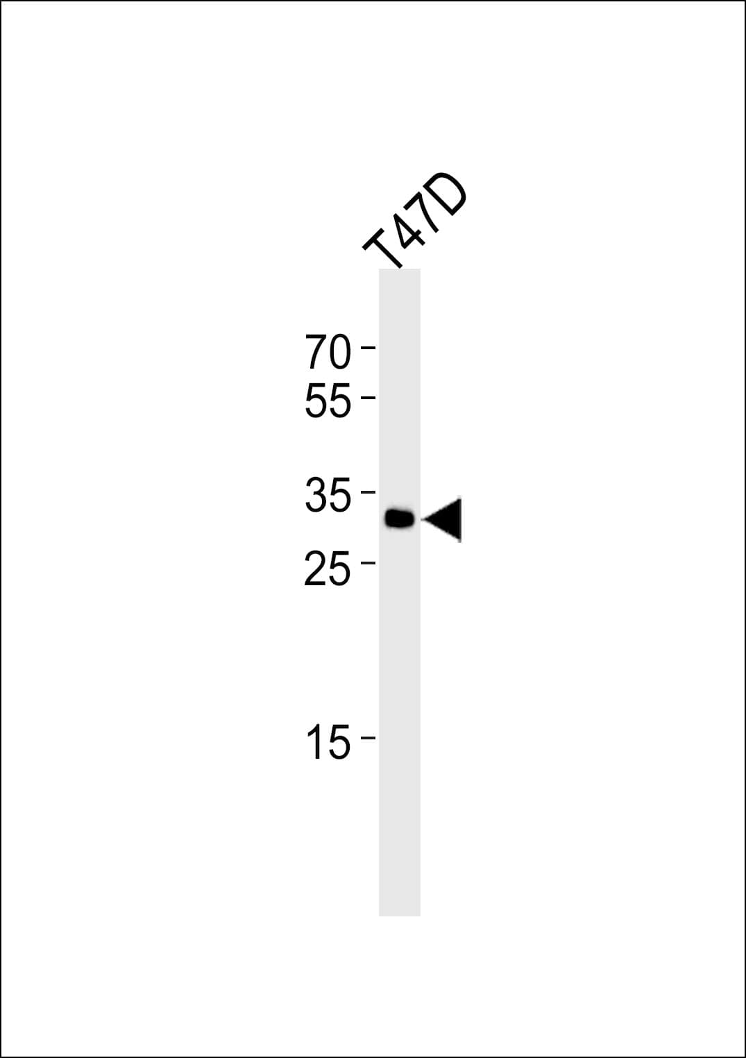 IHC-plus™ ING4 Antibody (aa162-195)