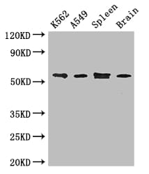 Polyclonal Rabbit anti-Human CORO1C Antibody (IF, WB)