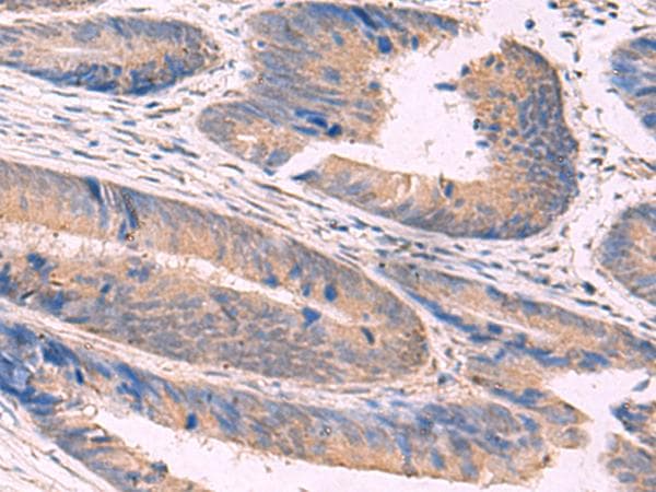 NIPSNAP1 Antibody
