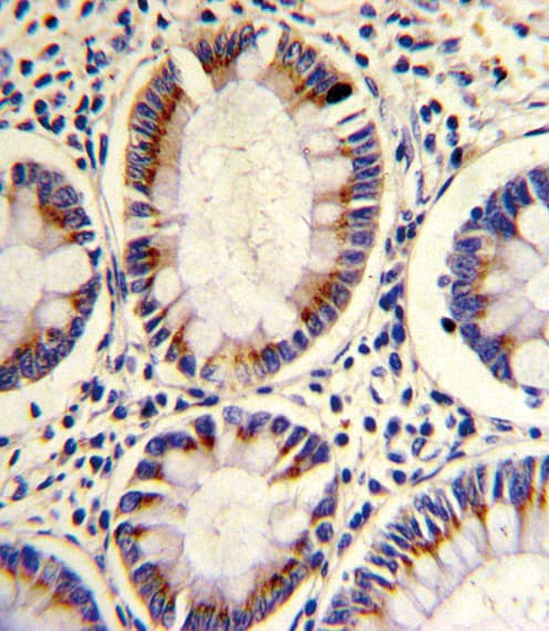 SORBS2 / ARGBP2 Antibody (aa175-204)
