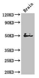 SPOCK1 / SPOCK / Testican Antibody