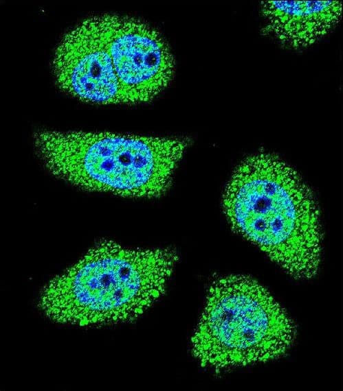 IHC-plus™ PAK6 Antibody (aa268-297)