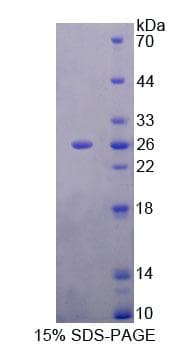 Rat MTUS1 Protein (Recombinant His-T7)