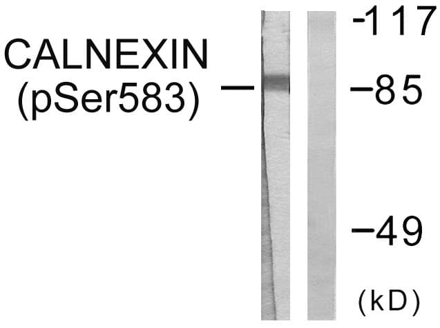 CANX / Calnexin Antibody (phospho-Ser583)