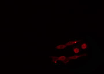 DGKE / DGK Epsilon Antibody
