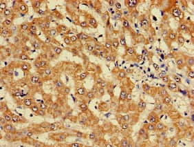 KIF17 Antibody