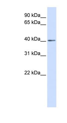 Polyclonal Rabbit anti-Human NKX3-2 / BAPX1 Antibody (aa180-229, WB)