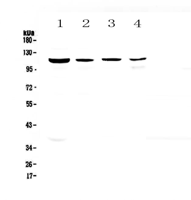 RPGR Antibody