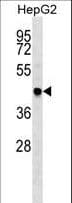 Polyclonal Rabbit anti-Human TRAF4 Antibody (aa427-455, WB)