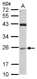 Polyclonal Rabbit anti-Human UBE2F Antibody (WB)