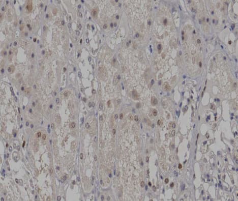 PARK2 / Parkin 2 Antibody