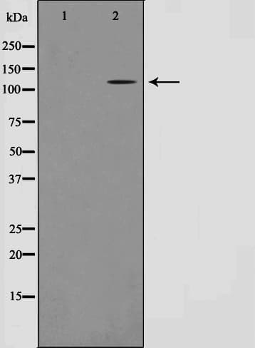TUBGCP5 / GPC5 Antibody