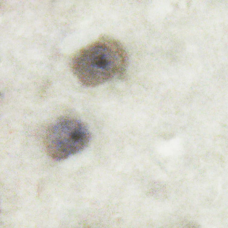 FAK / Focal Adhesion Kinase Antibody (phospho-Tyr576)