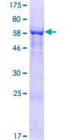 Human DENND1B Protein (Recombinant GST)