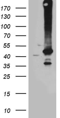 Monoclonal Mouse anti-Human GNA14 Antibody (clone OTI3E8, aa31-348, IHC, WB)