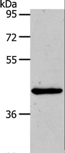 MMP13 Antibody