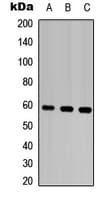 MMP28 Antibody (Internal)