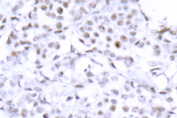 SMC1A / SMC1 Antibody (Ser951)
