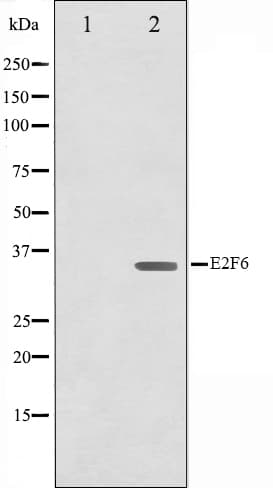 Polyclonal Rabbit anti-Human E2F6 Antibody (IHC, IF, WB)