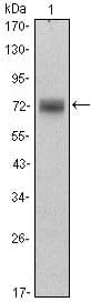 ZBTB16 / PLZF Antibody (clone 5B3)